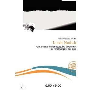  Lisch Nodule (9786200671110) Wade Anastasia Jere Books