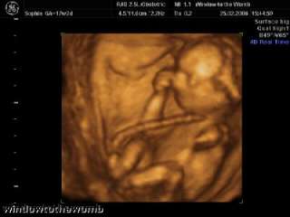 4D ULTRASOUND PICTURES 28 34 WEEKS items in WINDOW TO THE WOMB 4D BABY 