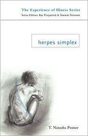 Herpes Simplex, (041510744X), T. Posner, Textbooks   