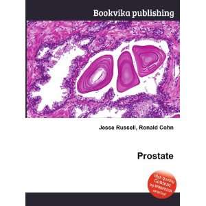  Prostate Ronald Cohn Jesse Russell Books