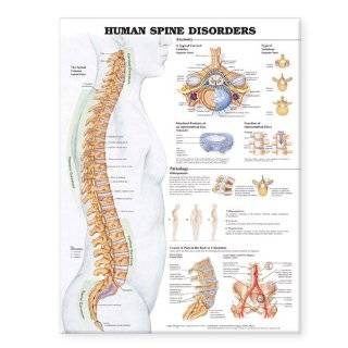 Human Spine Disorders Anatomical Chart  Industrial 